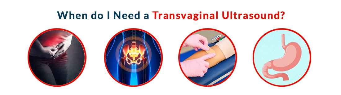 When do I Need a Transvaginal Ultrasound
